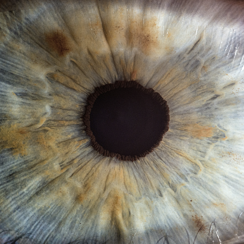 iridologia